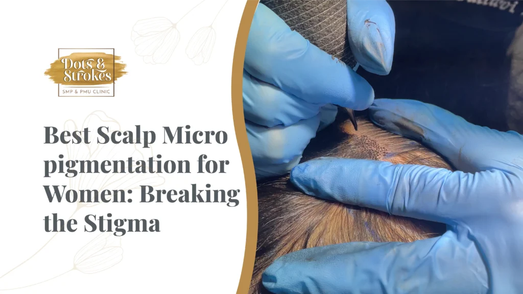 Best Scalp Micro pigmentation for Women: Breaking the Stigma
